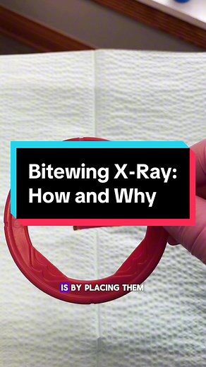 What is a Bitewing X-ray? Tips and Tricks for taking. #dentalassistant #teeth #dentalassistantlife