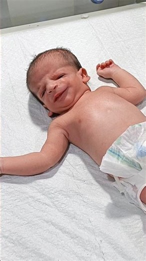 👑“Tiny Jaw, Big Strength 💕 Micrognathia Baby’s Inspiring Moment” #babydream #unfrezzmyaccount #cute