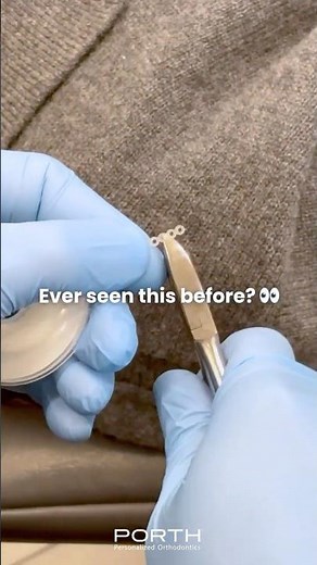 The secret tool that makes braces work faster 👇