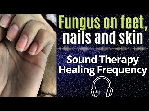 Fungus Elimination Protocol: Rife Frequency to Target Toenail, Skin & Foot Fungus at Source