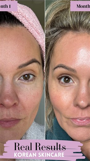 This skincare has transformed my skin!!! And it’s on sale!! Check out my highlight bubble skincare sale for more deets! Or comment if you have questions 冀 | Tracy Lane | Facebook