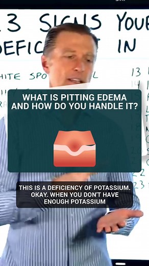 Understanding Pitting Edema: Causes and Remedies