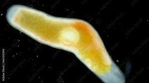 Parasitic worm Progonus muelleri under a microscope, at metacercaria stage. Class Trematoda. White Sea