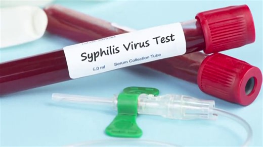 Syphilis rates in the U.S. up 80% since 2018
