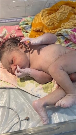 Neonatal Peripheral Cyanosis