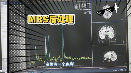 磁共振MRS后处理