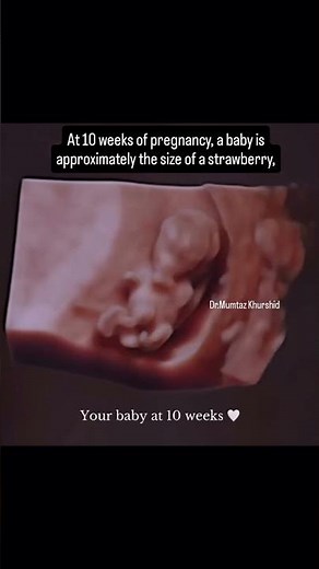 12 Weeks Cute Baby Moments Inside Womb During Ultrasound