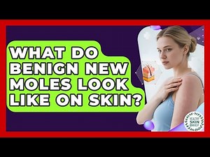 What Do Benign New Moles Look Like On Skin? - Healthy Skin Brief