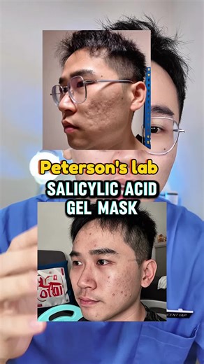 Peterson's Lab Salicylic Acid Gel Mask for Acne Treatment