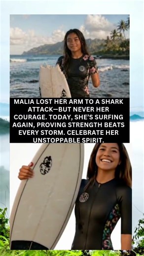 She Lost Her Arm to a Shark… But Came Back Stronger Than Ever