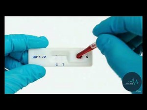 HOW TO Use an HIV Self-Test Kit at Home (Finger Prick Tutorial)