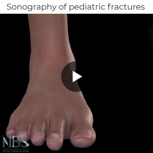 #pocus #ultrasound #pediatricemergency #emergencymedicine #pediatrictrauma | Eckehart Schöll