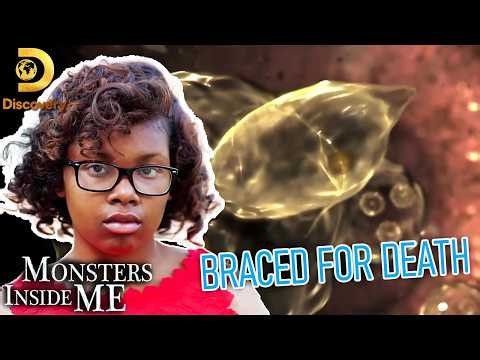 Monsters Inside Me Full Episodes |S08E07⚡ Braced for Death ⚡ Documentary | Medical Examiner 2026