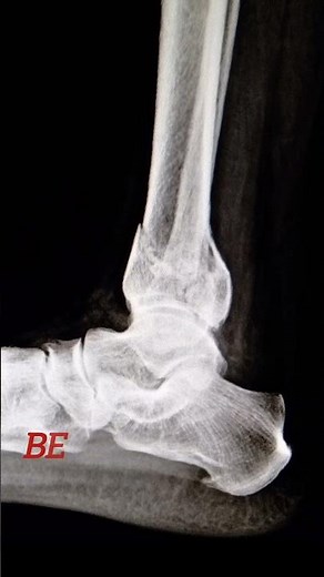 Before xray And After x-ray ☢️⚡ #radiology #radiography #xray #aiims #medical #paramedical #anatomy