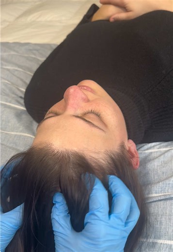 Feedback requested 🫶 Personally, I love it | ASMR Medical Roleplay | Hairplay to pamper you | Personal attention for deep relaxation 🫠💤💙🫶 #asmr #asmrvideo #asmrforsleep #asmrscalpmassage #fyp