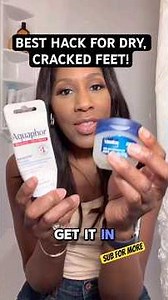 BEST HACK FOR DRY, CRACKED FEET 👣! #shortsfeed #shortsvideo #shorts