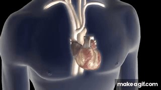 Atrial Fibrillation Animation on Make a GIF