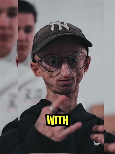 Don't Panic with this Rare Body Condition😱😱