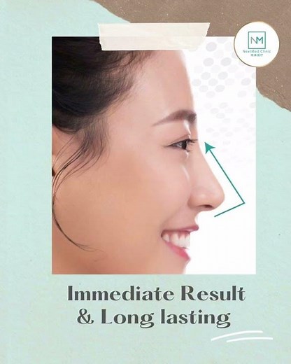 NextMed Nose Thread Lift