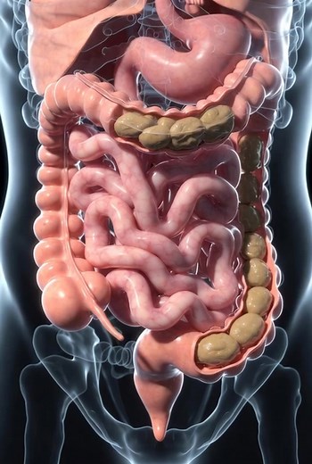 When you don’t eat enough fiber, your poop becomes hard, dry, and difficult to pass. That’s why a fiber-rich diet is essential for keeping your digestion smooth and healthy! 🌿💪 High-fiber foods to include in your diet: 🥦 Broccoli & leafy greens 🍎 Apples, pears & berries 🌾 Oats, whole grains & bran 🥜 Nuts & seeds (almonds, chia, flaxseeds) 🥕 Carrots, sweet potatoes & other root veggies 🥗 Legumes like beans, lentils & chickpeas Eat more fiber for a happier, healthier gut! #HealthTips #Dige