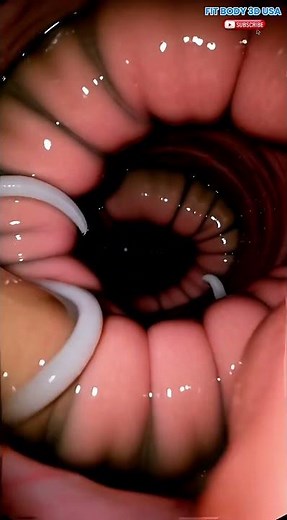 Real Intestinal Endoscopy Animation | 4K Medical Visualization