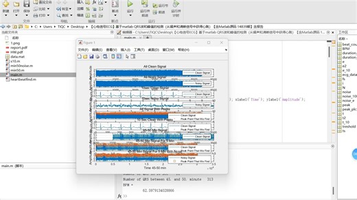 【心电信号ECG】基于matlab QRS波和峰值的检测（从噪声和清晰信号中获得心跳）【含Matlab源码 14839期】含报告