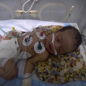 2.6K reactions · 1.6K shares | After five years of war, people in Yemen have some of the lowest levels of immunity and highest levels of vulnerability in the world. If that wasn’t enough, only half the hospitals are open. | UNFPA | Facebook