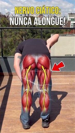 The truth about stretching your sciatic nerve #sciatica #physicaltherapy #tips