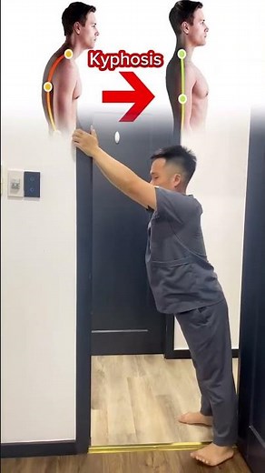 Kyphosis: understanding the condition, its causes, symptoms, and treatment#kyphosis #kyphosistretmen