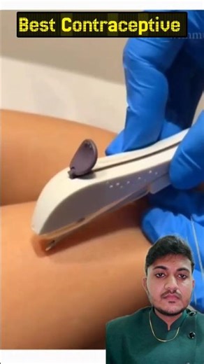Best Contraceptive #contraceptiveimplant #contraception #birthcontrol #unwantedpregnancy