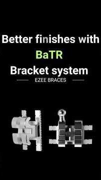 Better finishes with BaTR Bracket system
