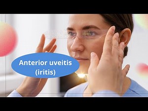 Anterior uveitis (#iritis) : What it is, symptoms, causes and treatment