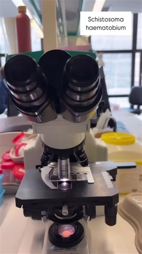 Urine sample direct under microscope of a patient from Senegal with blood in urine 🤔 #microbiology #microbiologist #lab #schistosomiasis #schistosomahaematobium