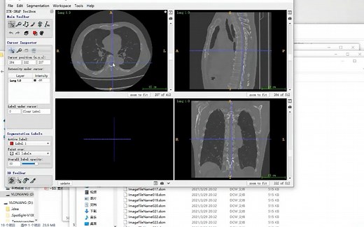 影像组学中最简单的dicom数据处理方法