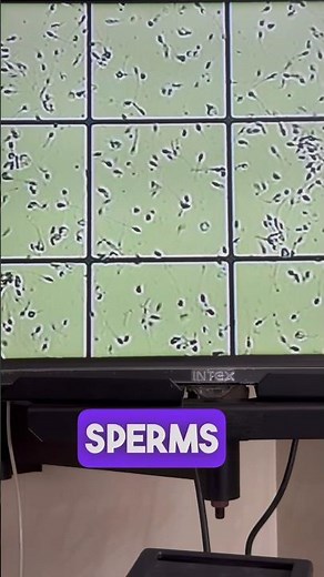 Identifying Sperm: Motile vs Immotile. Live Demonstration