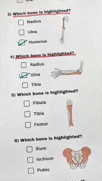 If You Pass This Bones Quiz, You’re Smarter Than Doctors 😳