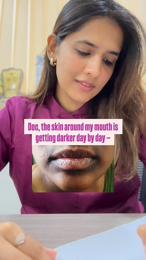 2.3K views | Dark patches around your mouth? Let’s decode it,...