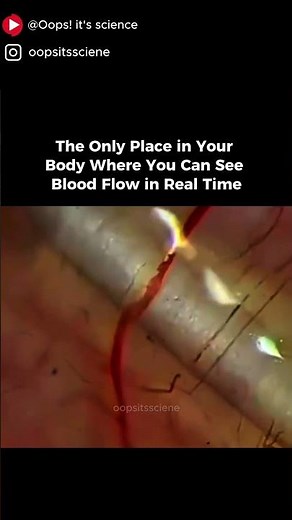 The Only Place in Your Body Where You Can See Bl**od Flow in Real Time 😳🩸 #didyouknow #science