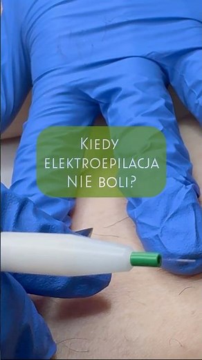 📌 Kiedy elektroepilacja NIE boli? #elektroepilacja #depilacja