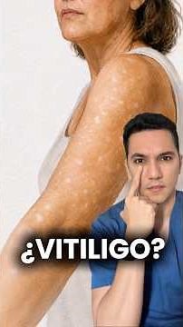 Small white spots on arms and legs: Vitiligo? #dermatology #dermatologistwilliamguerrero