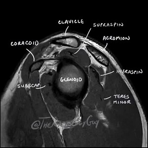 SHOULDER EXAMINATION ⠀ [T1 SAGITTAL MRI SEQUENCE] ⠀ This are a few slices through the shoulder region from lateral view with main aspect on the rotator cuff (S.I.T.S.). ⠀ The rotator cuff is a group of four muscles and their tendons which serve to stabilize the glenohumeral joint. ⠀ S.: Supraspinatus I.: Infraspinatus T.: Teres Minor S.: Subscapularis ⠀ I just finished a rotator cuff series, for more information about each muscle involved (anatomy, pathology, palpation, treatment, etc.) check my