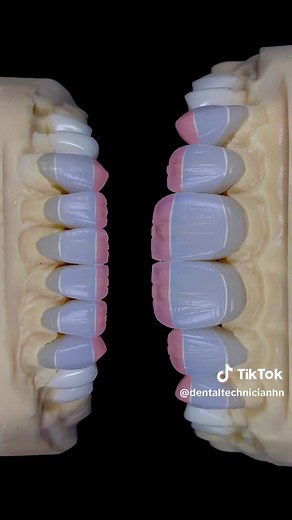 Thanks for sharing #dentaltechnician #dentallab #dentistry #lab #smile #smilemakeover #dentalceramic #ceramic #wax #waxup #tooth #teeth #crown #morphology #veneer #layering #buildup #texture #longervideos