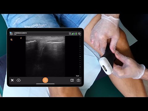 Ultrasound Examination of the Knee