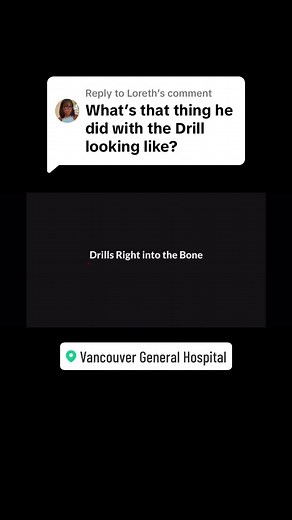 Replying to @Loreth #io #intraosseous #drill