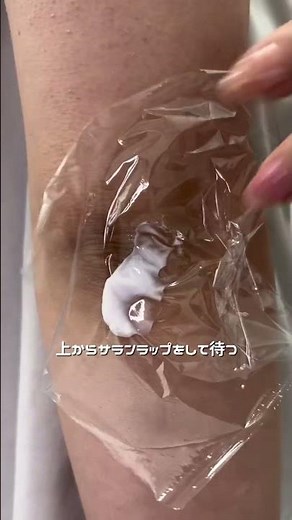 その肘のケア逆効果かも？！正しいケアの方法はこちらです🥰💗#美容 #垢抜け #黒ずみ #シワ #検証 pr