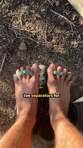 Toe separators for hiking?