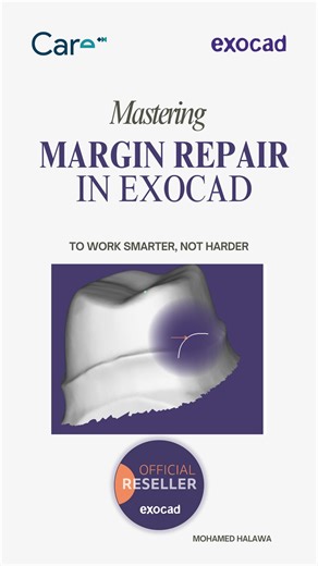 Abo Moayad on Instagram: "🦷 Mastering the Margin Line in exocadofficial_ Exocad Getting the margin line right is the key to achieving accurate, well-fitting restorations. With Exocad’s powerful tools, you can define margins with precision, improve adaptation, and reduce adjustments chairside. A clean margin line = a perfect restoration. Keep practicing… your designs will speak for themselves! This tutorial is brought to you with the support of @alliedstar_official using the AS 260 Scanner, exoc