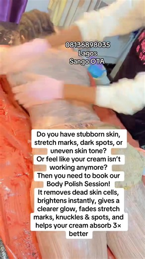 Do you have stubborn skin, stretch marks, dark spots, or uneven skin tone? Or feel like your cream isn’t working anymore? Then you need to book our Body Polish Session! It removes dead skin cells, brightens instantly, gives a clearer glow, fades stretch marks, knuckles & spots, and helps your cream absorb 3× better #foryoupage❤️❤️ #viraltiktok #skincare #fypシ゚ #fypシ゚viral🖤tiktok☆♡🦋myvideo