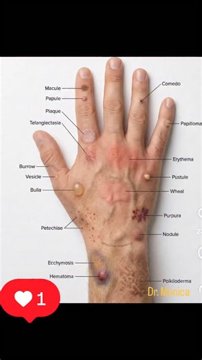 Dr. Monica Aglawe on Instagram: "Hello Doctors 🏥💊"