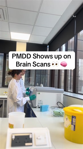 PMDD Visible in Brain Scans, AI Confirms